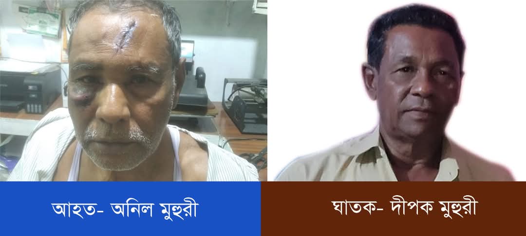 উঠানে পাইপ বসানোর বিরোধে ভাইয়ের কোপে ভাই জখম!